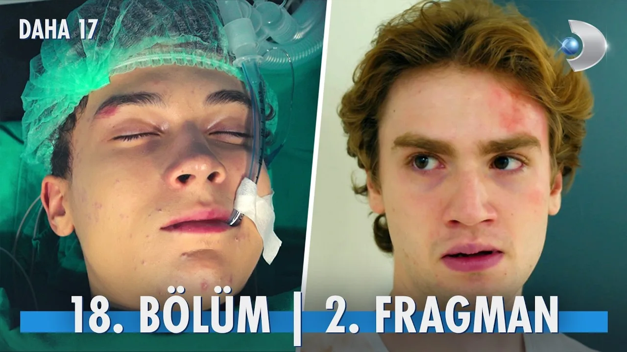 Daha 17 18.Bölüm 2. Fragmanı